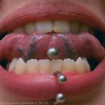 Zungenpiercing und Zähne