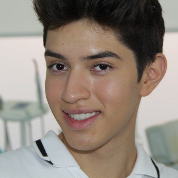 young male dental veneers photo