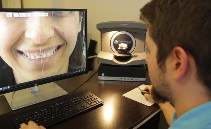 Technician working on a smile design