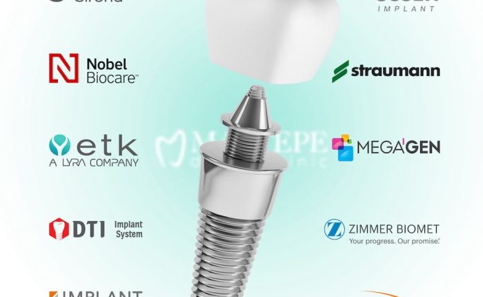 best dental implant brands