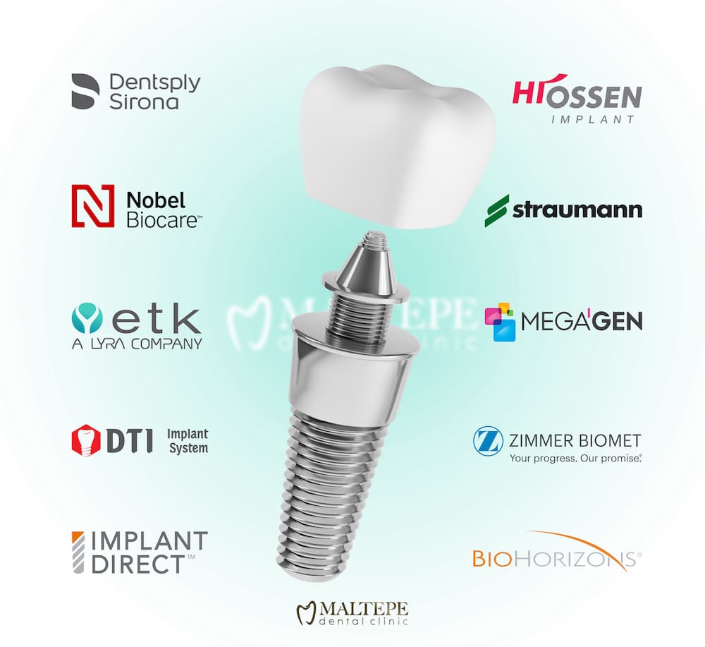 best dental implant brands