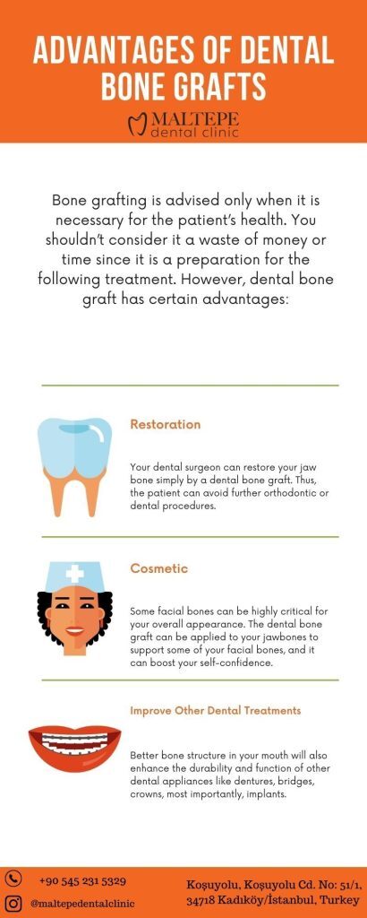 Advantages Of Dental Bone Grafts