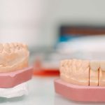 Dental Crown On Mouth Model
