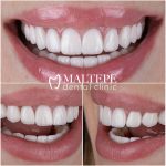 Perfect teeth close-up images
