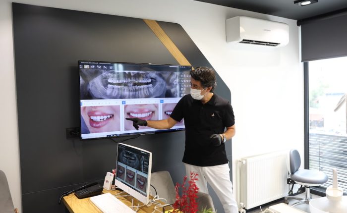 Dentist examining full mouth dental implant treatment on screen