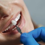 11dentist reshaping teeth