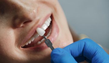 dentist reshaping teeth