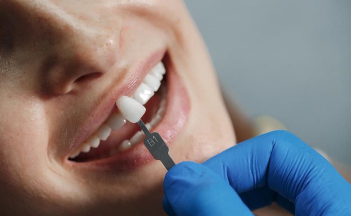 dentist reshaping teeth