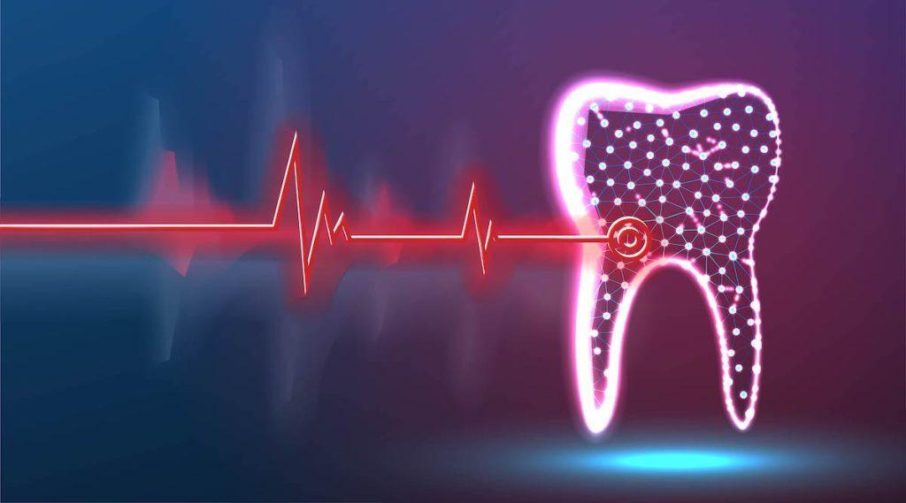 Die Vielseitigkeit von Zahnlasern: Von Zahnaufhellung bis Zahnfleischchirurgie
