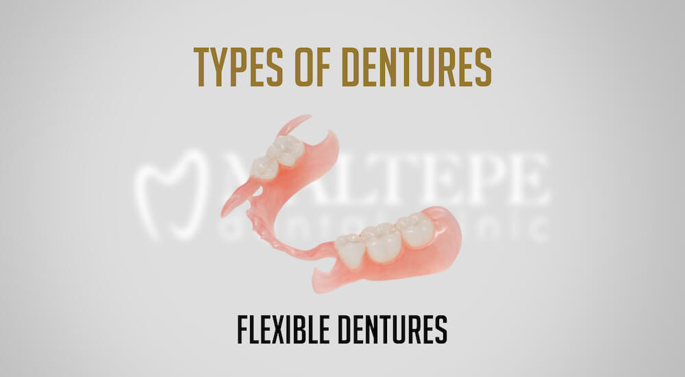flexible denture