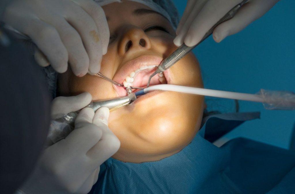 Traditionelle Implantatchirurgie