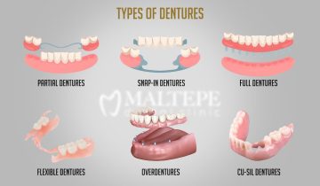 denture types