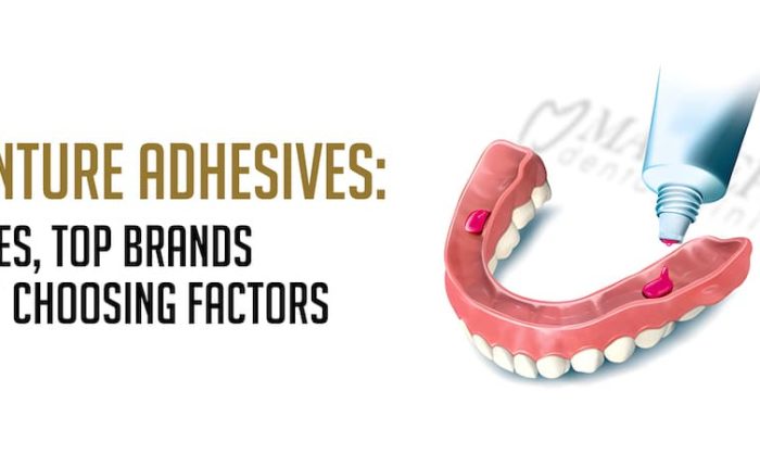 Denture adhesive types, top Brands and choosing factors